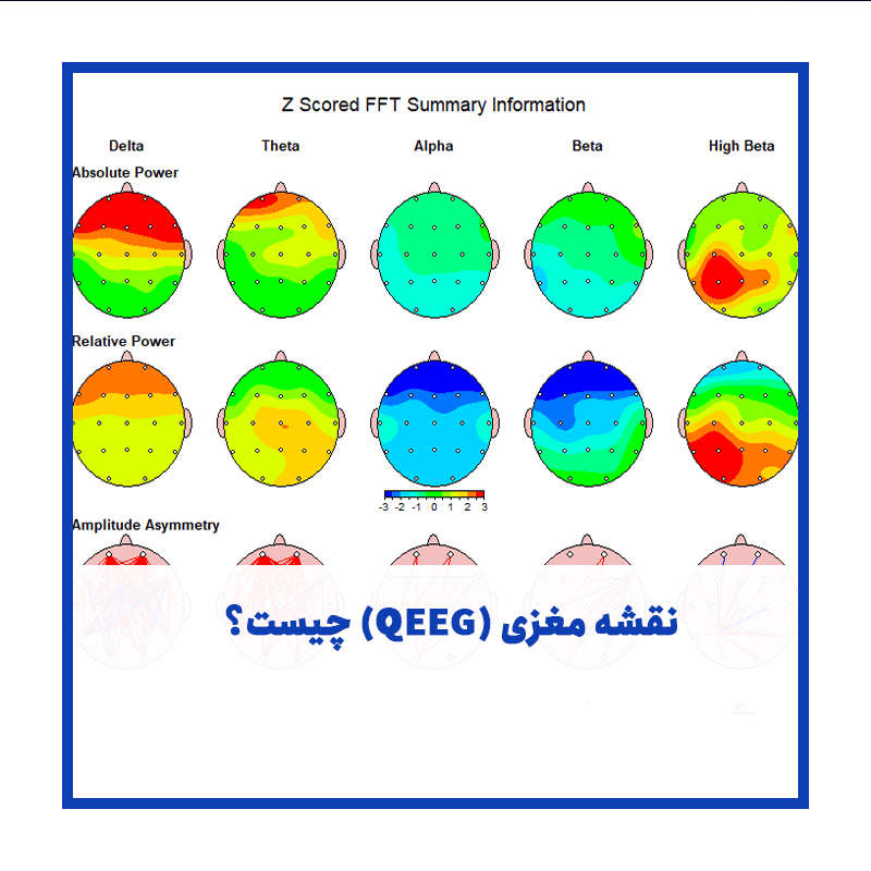 چیست؟ (QEEG) نقشه مغزی
