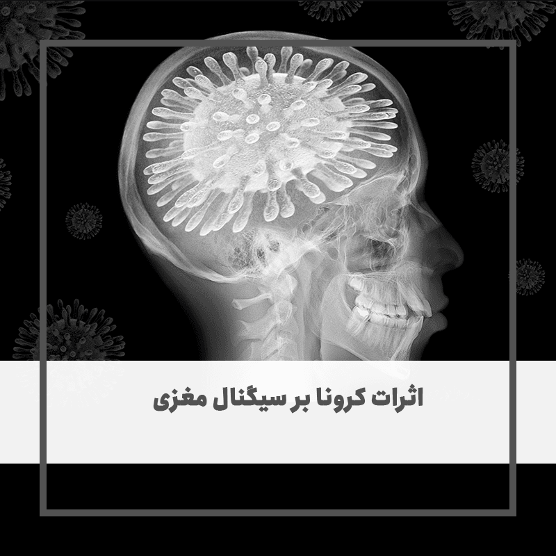 اثرات کرونا بر سیگنال مغزی