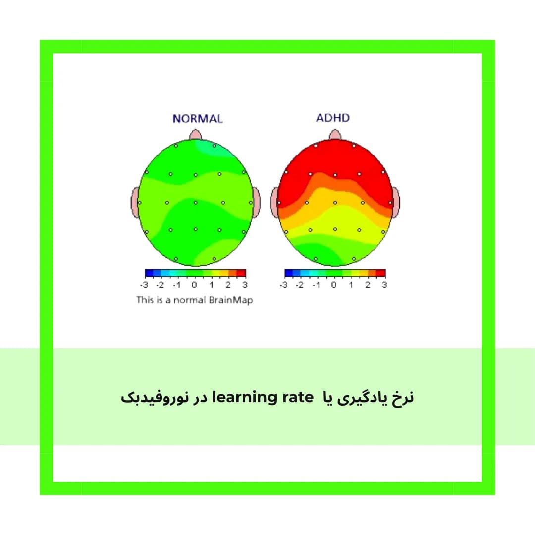 نرخ یادگیری یا learning rate چیست؟